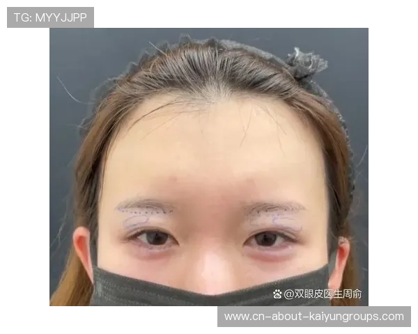 眉角开裂：场边缝合四针的速归，眉角开裂怎么处理
